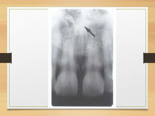 Normal radiographic anatomy in a human.pdf