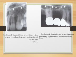 Human Normal Radiograph Normal radiographic anatomy in a human.pdf