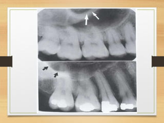 Human Normal Radiograph Normal radiographic anatomy in a human.pdf