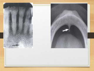 Normal radiographic anatomy in a human.pdf