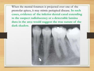 Human Normal Radiograph Normal radiographic anatomy in a human.pdf