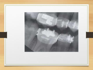 Normal radiographic anatomy in a human.pdf