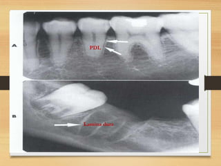 Human Normal Radiograph Normal radiographic anatomy in a human.pdf