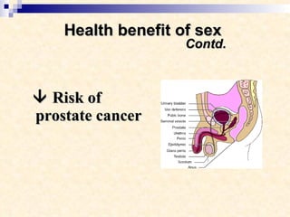 Health benefit of sex    Contd.    Risk of prostate cancer 