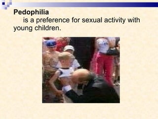 Pedophilia   is a preference for sexual activity with young children.   