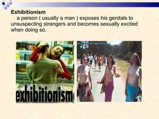 Exhibitionism   a person ( usually a man ) exposes his genitals to unsuspecting strangers and becomes sexually excited when doing so. 