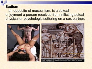 Sadism   an opposite of masochism, is a sexual enjoyment a person receives from inflicting actual physical or psychologic suffering on a sex partner. 