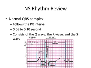 NS Rhythm Review
• Normal QRS complex
  – Follows the PR interval
  – 0.06 to 0.10 second
  – Consists of the Q wave, the R wave, and the S
    wave
 