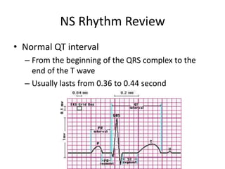 NS Rhythm Review
• Normal QT interval
  – From the beginning of the QRS complex to the
    end of the T wave
  – Usually lasts from 0.36 to 0.44 second
 