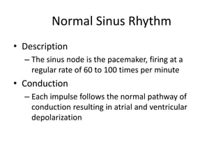 Normal Sinus Rhythm
• Description
  – The sinus node is the pacemaker, firing at a
    regular rate of 60 to 100 times per minute
• Conduction
  – Each impulse follows the normal pathway of
    conduction resulting in atrial and ventricular
    depolarization
 