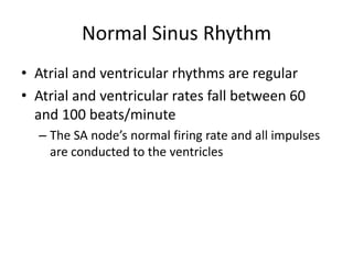 Normal Sinus Rhythm
• Atrial and ventricular rhythms are regular
• Atrial and ventricular rates fall between 60
  and 100 beats/minute
  – The SA node’s normal firing rate and all impulses
    are conducted to the ventricles
 