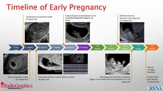 Gestational sac becomes visible
(5 weeks GA)
Yolk sac becomes visible
(5.5 weeks GA)
Fetal pole and heart motion become visible
(6 weeks GA)
Embryo begins to show features and
rhombencephalon begins to
form
(between 8–10 weeks GA)
Detailed anatomy
becomes more apparent
(12 weeks GA)
Yolk sac
no longer
visualized
Amnion fuses
with chorion
(14 weeks GA)
Timeline of Early Pregnancy
8-10 weeks 12 weeks and beyond
P
a
g
e
:
3
2
o
f
8
2 P
a
g
e
:
3
2
o
f
8
2
I
M
:
3
2 I
M
:
3
2
Gestation
al Age
(GA)
5 weeks 6 weeks 7 weeks 8 weeks 9 weeks
10
weeks
11
weeks
12
weeks
13
weeks
14
weeks
Physiologic gut herniation completes
(begins at 6–8 weeks GA and completes at 12–13
weeks GA)
 