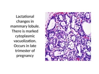 Normal Brea NORMAL STRUCTURE OF BREAST AND BENIGN LESIONS OF (2).pptx