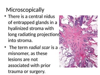 Normal Brea NORMAL STRUCTURE OF BREAST AND BENIGN LESIONS OF (2).pptx
