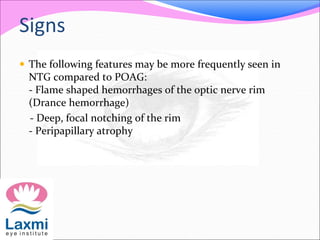Signs
 The following features may be more frequently seen in
NTG compared to POAG:
- Flame shaped hemorrhages of the optic nerve rim
(Drance hemorrhage)
- Deep, focal notching of the rim
- Peripapillary atrophy
 