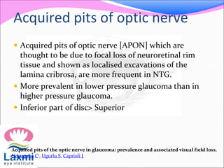 Acquired pits of optic nerve
 Acquired pits of optic nerve [APON] which are
thought to be due to focal loss of neuroretinal rim
tissue and shown as localised excavations of the
lamina cribrosa, are more frequent in NTG.
 More prevalent in lower pressure glaucoma than in
higher pressure glaucoma.
 Inferior part of disc> Superior
Acquired pits of the optic nerve in glaucoma: prevalence and associated visual field loss.
Nduaguba C1, Ugurlu S, Caprioli J.
 
