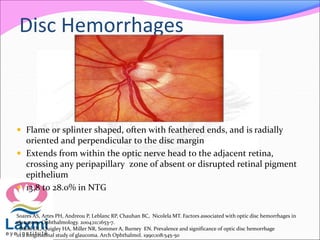 Disc Hemorrhages
 Flame or splinter shaped, often with feathered ends, and is radially
oriented and perpendicular to the disc margin
 Extends from within the optic nerve head to the adjacent retina,
crossing any peripapillary zone of absent or disrupted retinal pigment
epithelium
 13.8 to 28.0% in NTG
Soares AS, Artes PH, Andreou P, Leblanc RP, Chauhan BC, Nicolela MT. Factors associated with optic disc hemorrhages in
glaucoma. Ophthalmology. 2004;111:1653-7.
. Diehl DL, Quigley HA, Miller NR, Sommer A, Burney EN. Prevalence and significance of optic disc hemorrhage
in a longitudinal study of glaucoma. Arch Ophthalmol. 1990;108:545-50
 