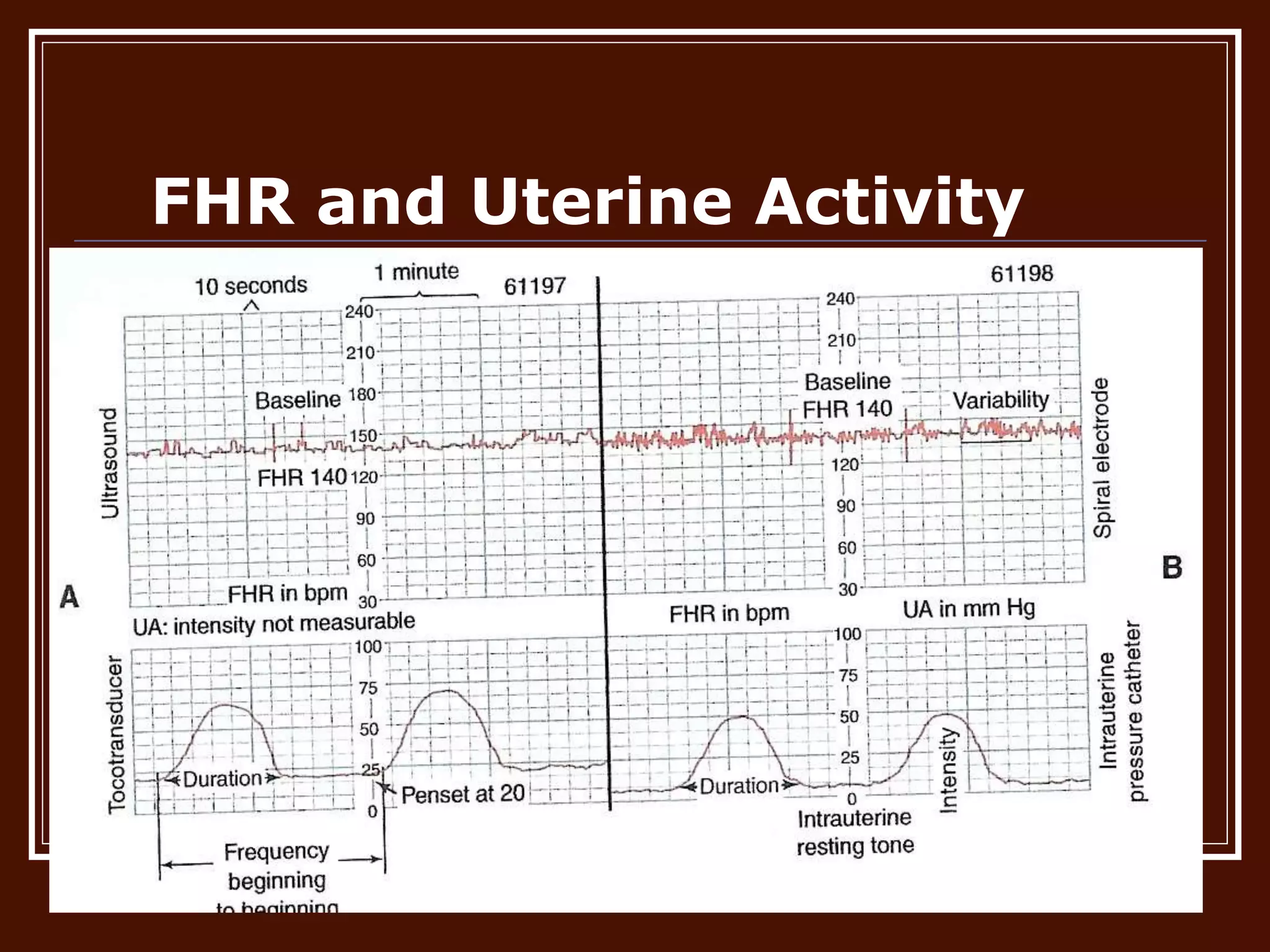 FHR and Uterine Activity
 