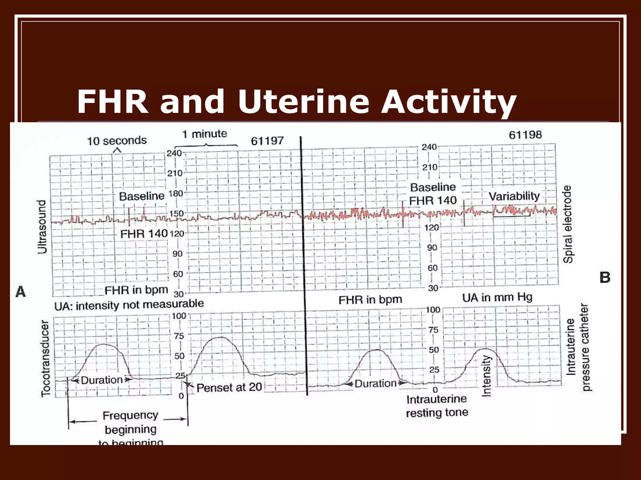 FHR and Uterine Activity
 