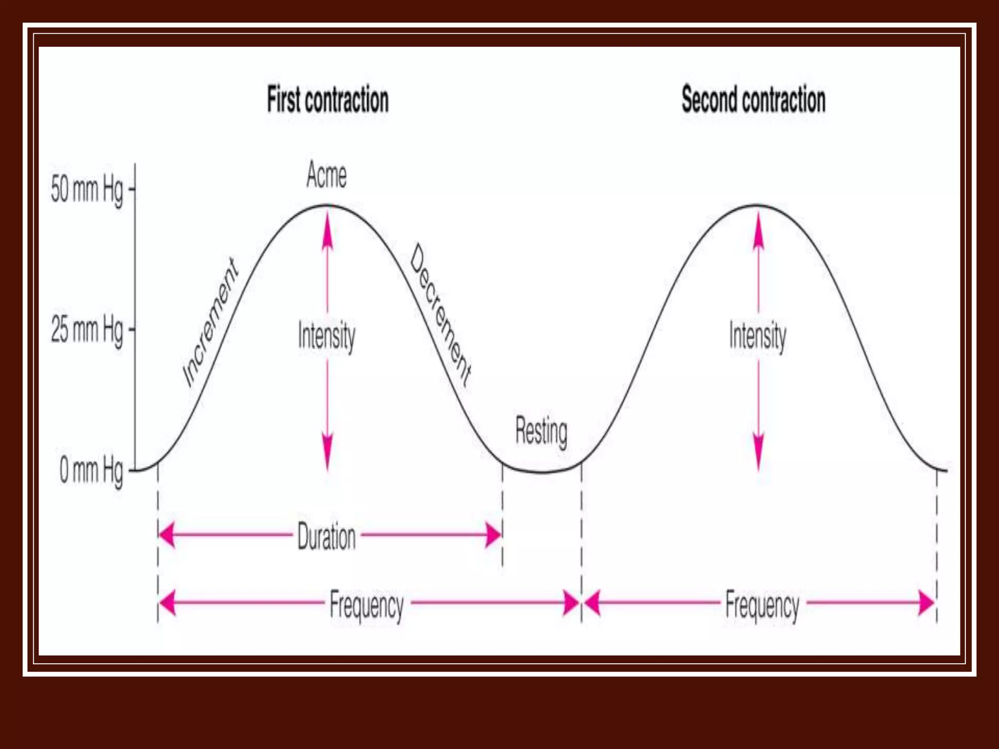 Uterine Contractions
 