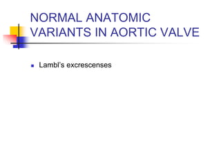 NORMAL ANATOMIC
VARIANTS IN AORTIC VALVE
 Lambl’s excrescenses
 