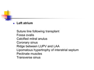  Left atrium
Suture line following transplant
Fossa ovalis
Calcified mitral anulus
Coronary sinus
Ridge between LUPV and LAA
Lipomatous hypertrophy of interatrial septum
Pectinate muscles
Transverse sinus
 