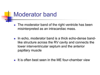 Moderator band
 The moderator band of the right ventricle has been
misinterpreted as an intracardiac mass.
 In echo, moderator band is a thick echo-dense band-
like structure across the RV cavity and connects the
lower interventricular septum and the anterior
papillary muscle
 It is often best seen in the ME four-chamber view
 