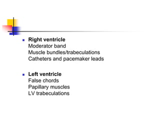  Right ventricle
Moderator band
Muscle bundles/trabeculations
Catheters and pacemaker leads
 Left ventricle
False chords
Papillary muscles
LV trabeculations
 