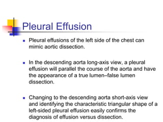 Pleural Effusion
 Pleural effusions of the left side of the chest can
mimic aortic dissection.
 In the descending aorta long-axis view, a pleural
effusion will parallel the course of the aorta and have
the appearance of a true lumen–false lumen
dissection.
 Changing to the descending aorta short-axis view
and identifying the characteristic triangular shape of a
left-sided pleural effusion easily confirms the
diagnosis of effusion versus dissection.
 