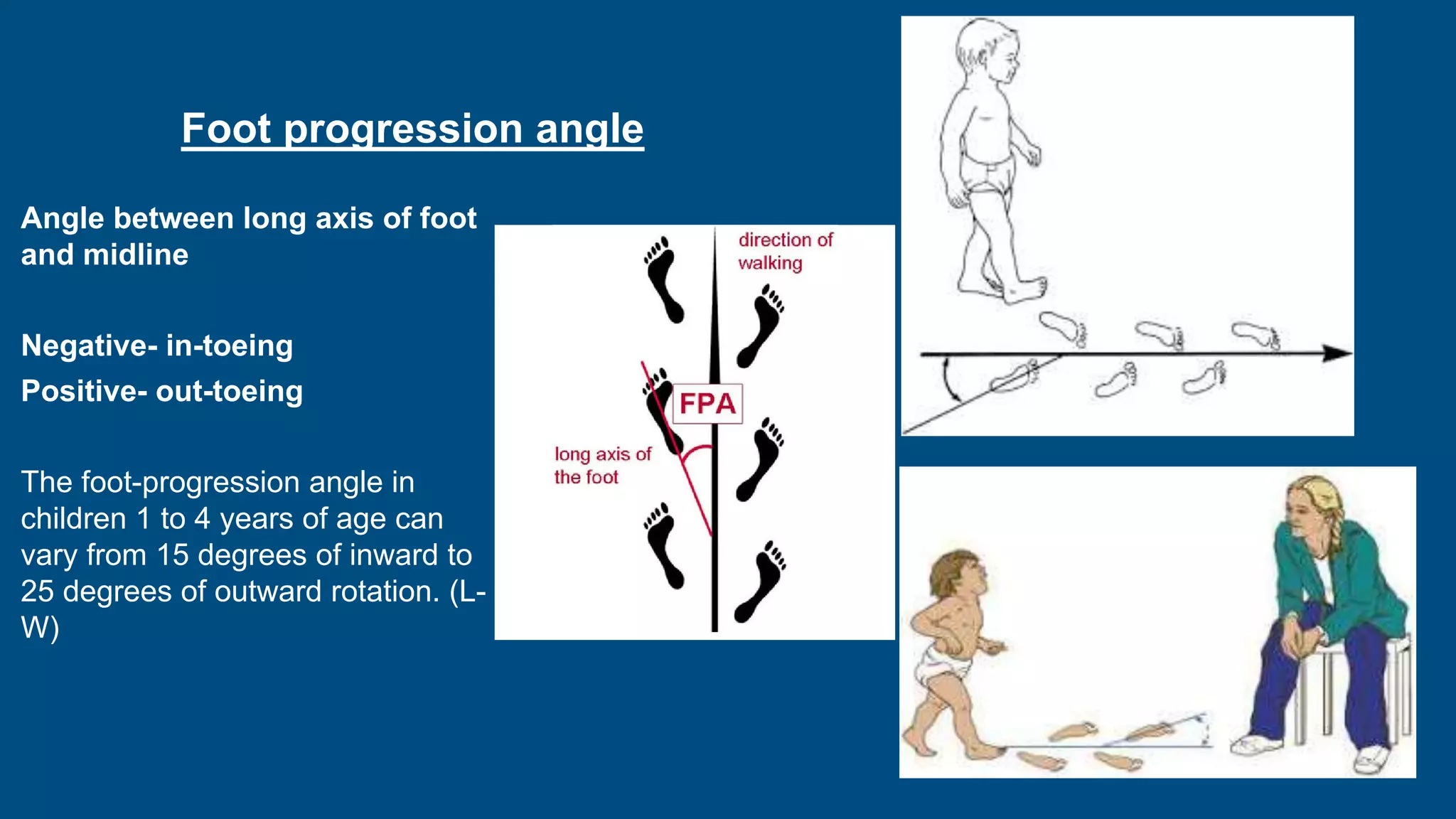 Foot progression angle
Angle between long axis of foot
and midline
Negative- in-toeing
Positive- out-toeing
The foot-progression angle in
children 1 to 4 years of age can
vary from 15 degrees of inward to
25 degrees of outward rotation. (L-
W)
 