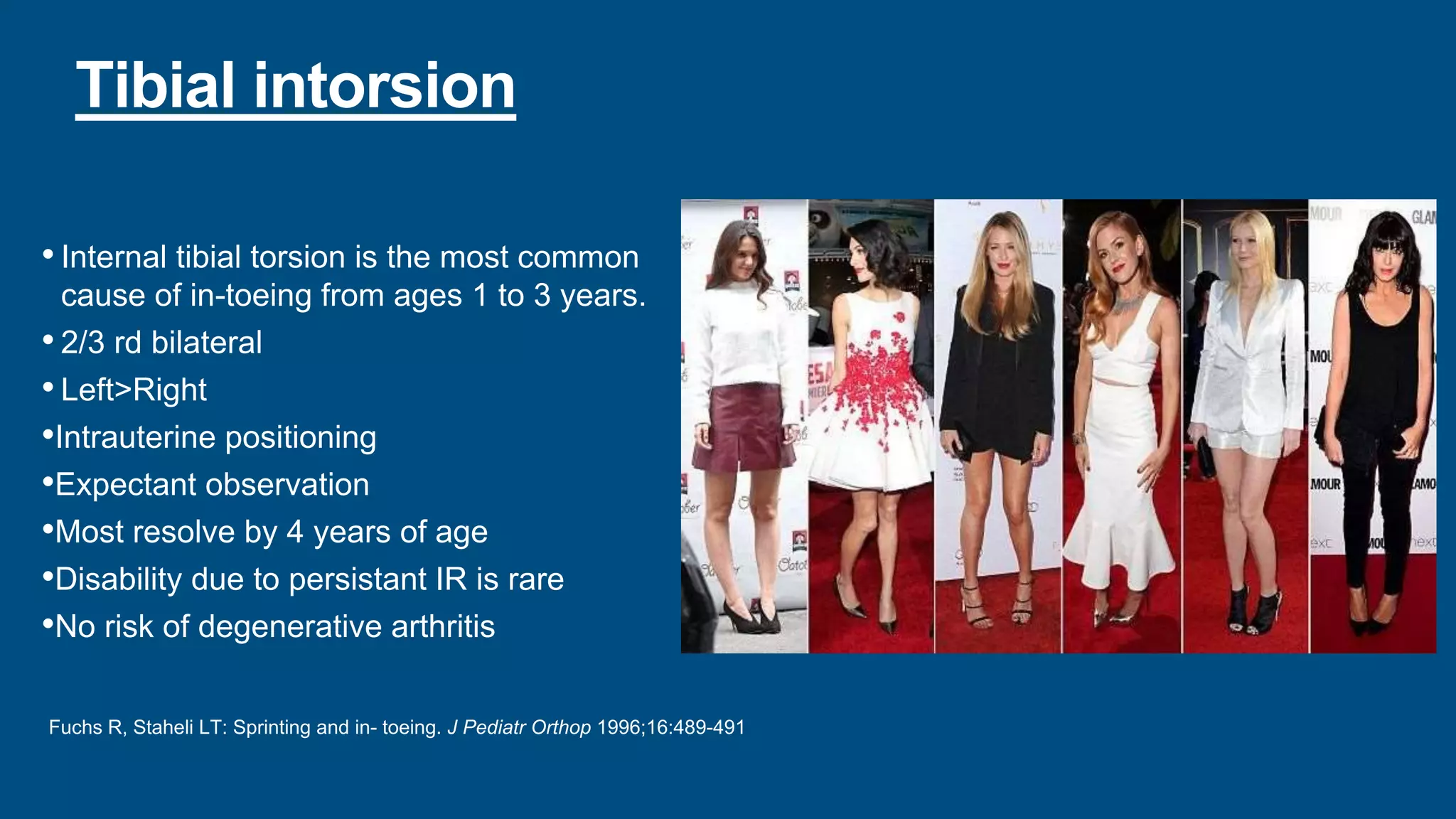 Tibial intorsion
• Internal tibial torsion is the most common
cause of in-toeing from ages 1 to 3 years.
• 2/3 rd bilateral
• Left>Right
•Intrauterine positioning
•Expectant observation
•Most resolve by 4 years of age
•Disability due to persistant IR is rare
•No risk of degenerative arthritis
Fuchs R, Staheli LT: Sprinting and in- toeing. J Pediatr Orthop 1996;16:489-491
 