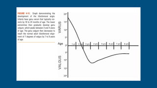 Normal variations in children | PPTX
