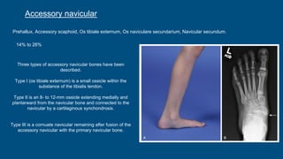 Normal variations in children | PPTX