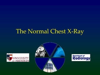 The Normal Chest X-Ray
 