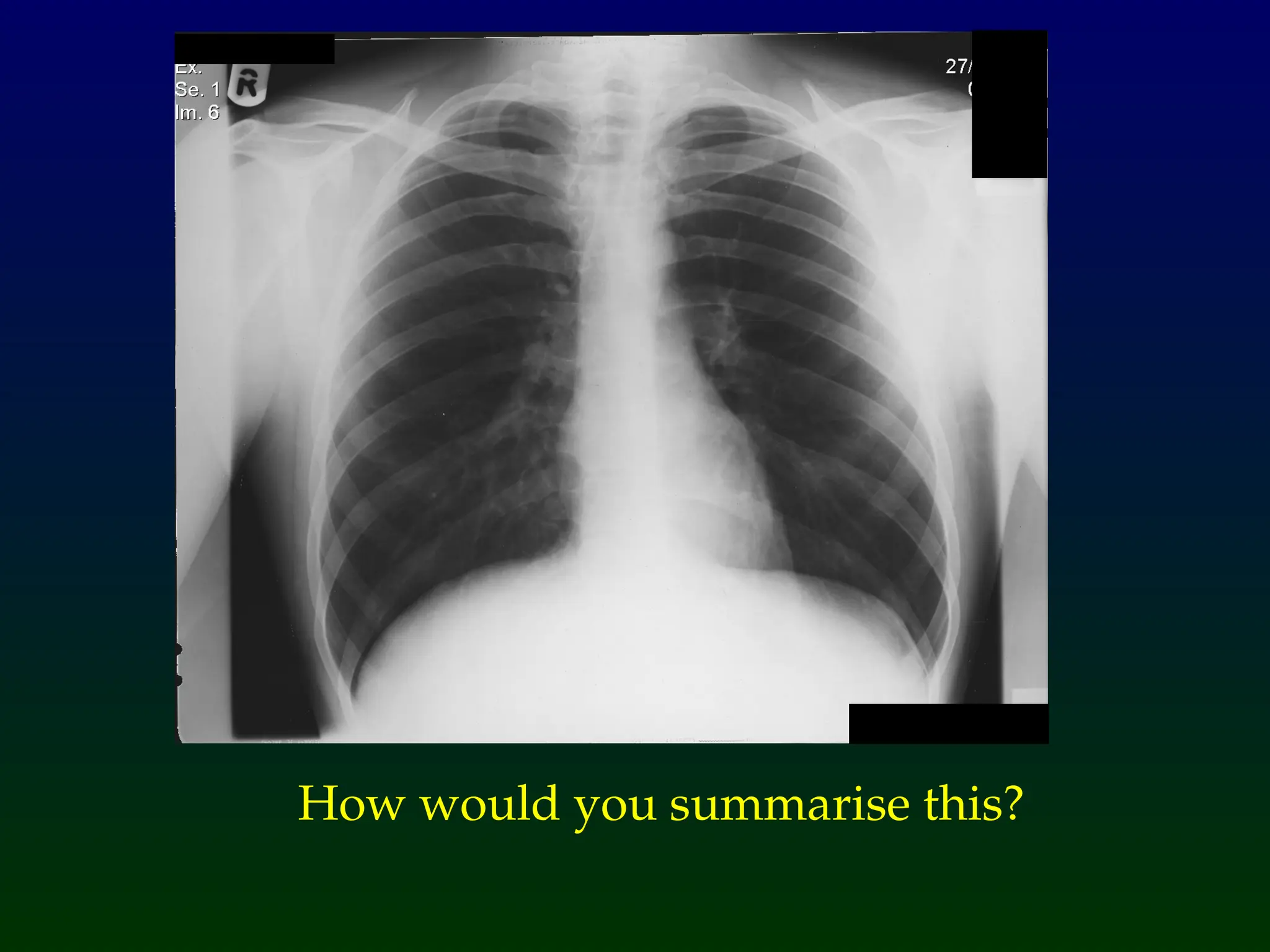 How would you summarise this?
 