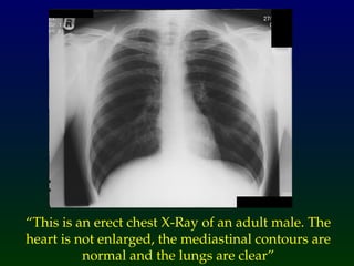 normal chest radiohgraphy interpretation .ppt