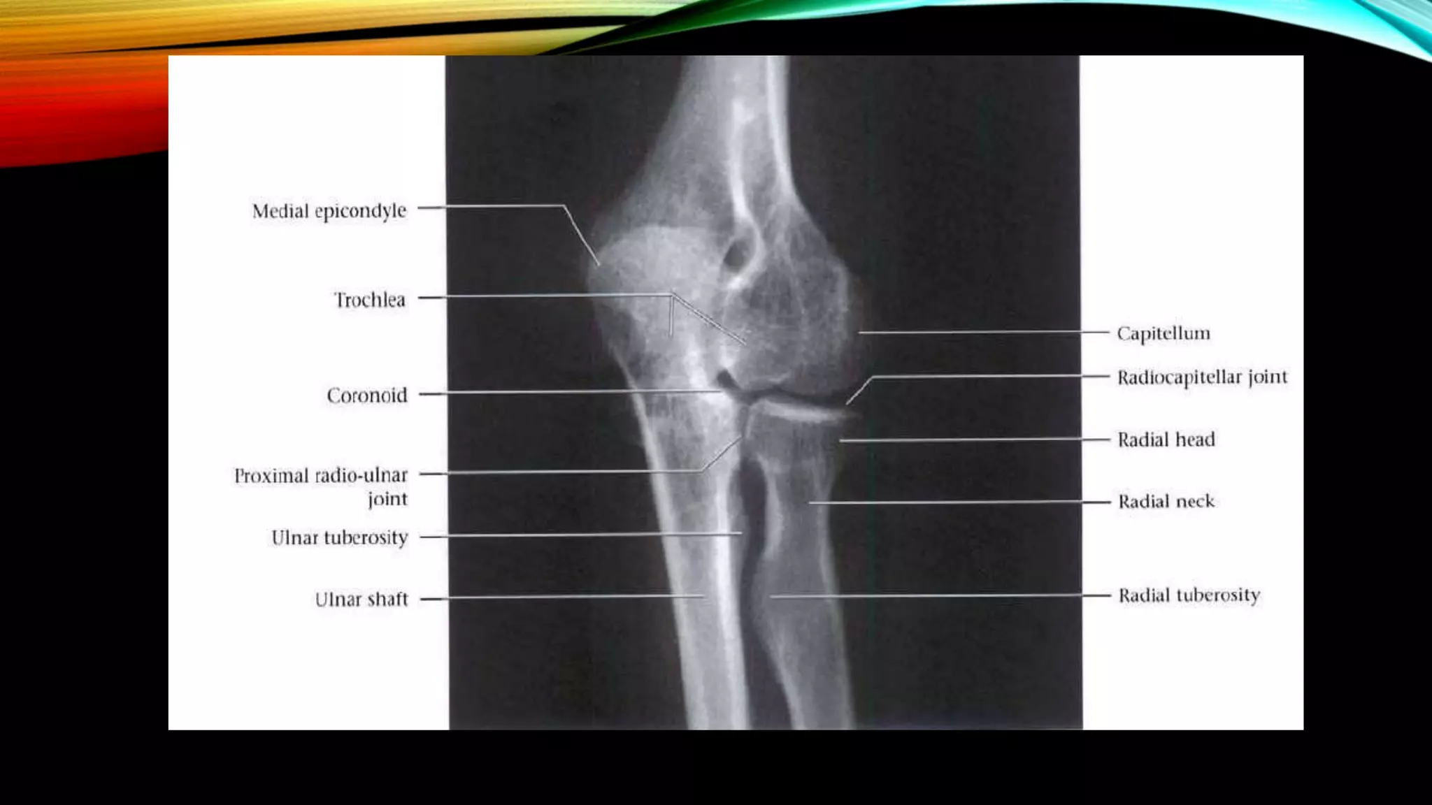 Normal X ray of long bones.pptx