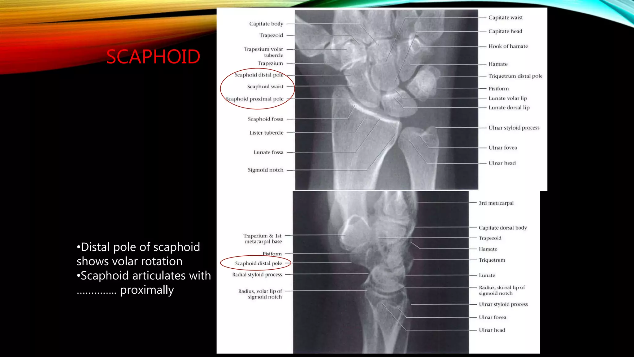 Normal X ray of long bones.pptx