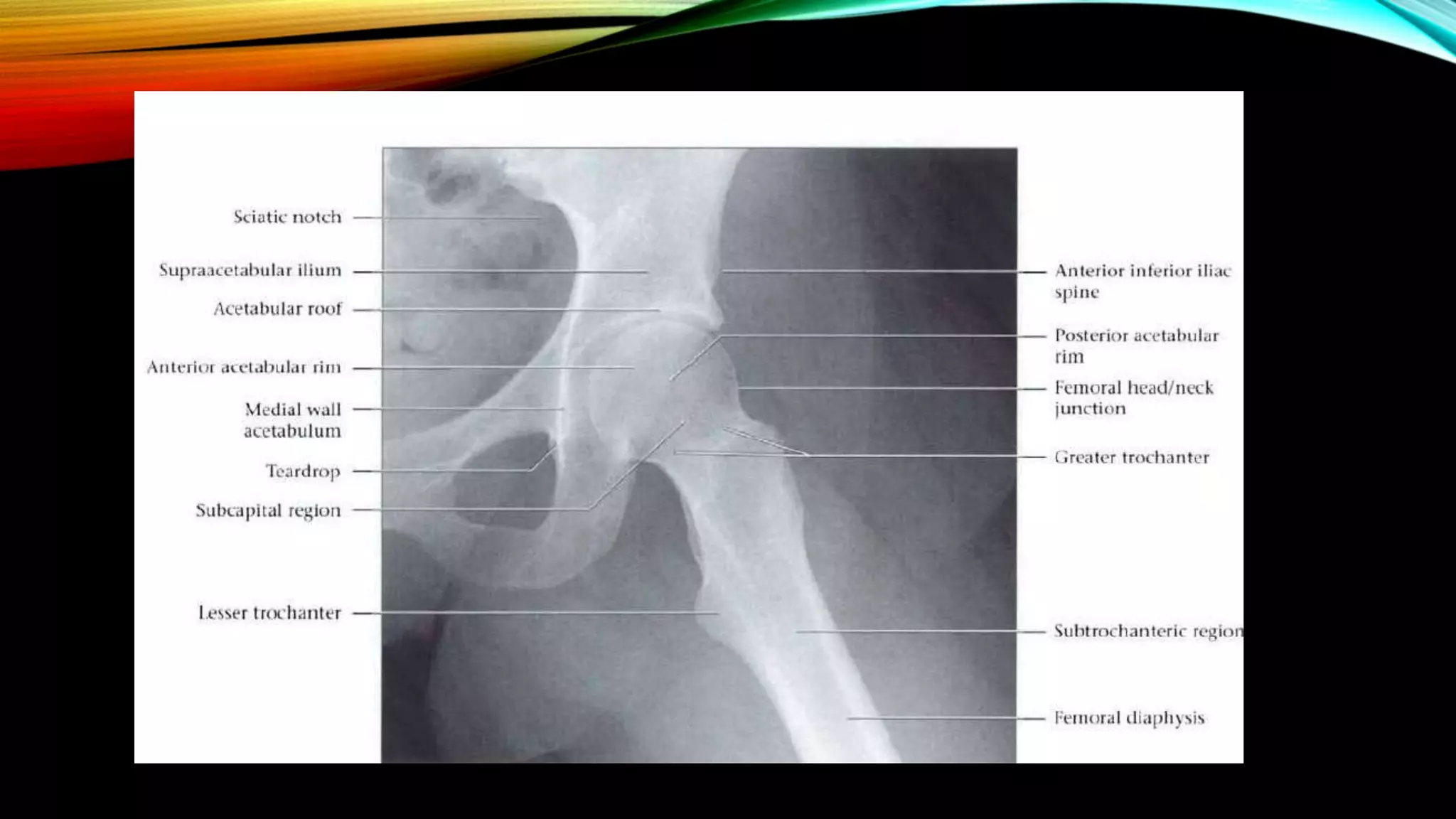 Normal X ray of long bones.pptx