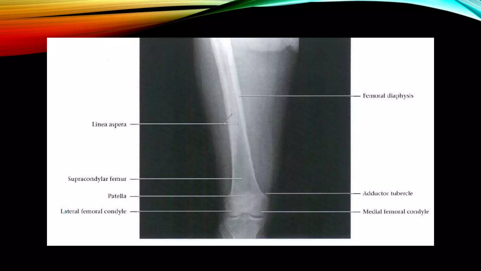 Normal X ray of long bones.pptx