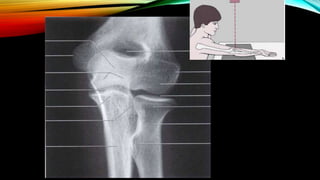 Normal Bone Rx Normal X ray of long bones.pptx