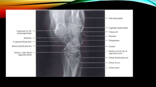 Normal Bone Rx Normal X ray of long bones.pptx