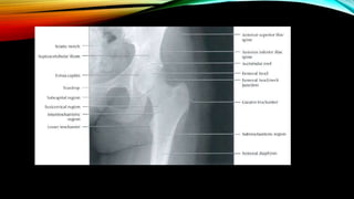 Normal Bone Rx Normal X ray of long bones.pptx