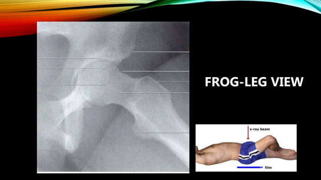Normal X ray of long bones.pptx