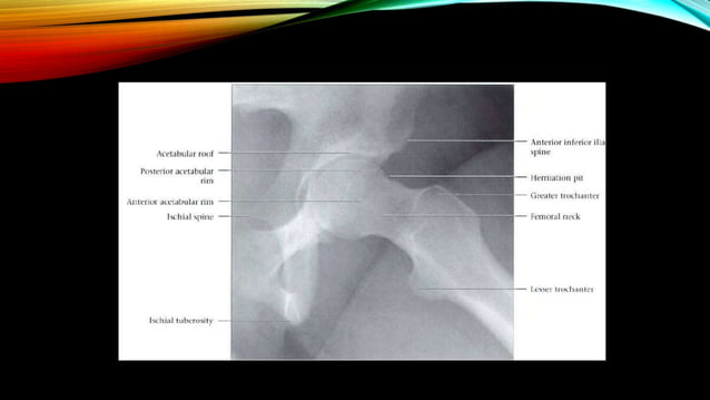 Normal X ray of long bones.pptx