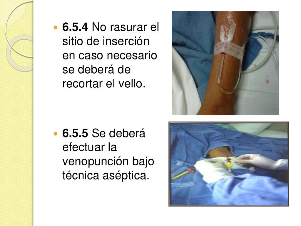 Norma oficial mexicana 022 terapia intravenosa