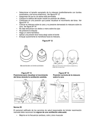 • Seleccionar el tamaño apropiado de la máscara (preferiblemente con bordes
acolchados y de forma anatómica). Ver figura Nº 12
• Asegúrese de que la vía aérea esté permeable
• Coloque la cabeza del recién nacido en posición de olfateo.
• Colóquese en una posición que pueda visualizar el movimiento del tórax. Ver
figura Nº 13
• Colocar la máscara sobre la cara y no presione demasiado la máscara sobre la
cara. Ver figura Nº 14
• No deje descansar sus dedos o mano sobre los ojos
• No presione la tráquea
• Haga un cierre hermético
• Aplicar una presión leve hacia abajo sobre el borde
• Empuje suavemente la mandíbula hacia la máscara.
Figura Nº 12
Figura Nº 13 Figura Nº 14
Posiciones para visualizar el movimiento Posición correcta de la máscara
del tórax durante la ventilación asistida. sobre la cara
Norma 29
El personal calificado de los servicios de salud responsable de brindar reanimación
neonatal debe reconocer los signos de una ventilación adecuada:
• Mejoría en la frecuencia cardíaca, color y tono muscular
 
