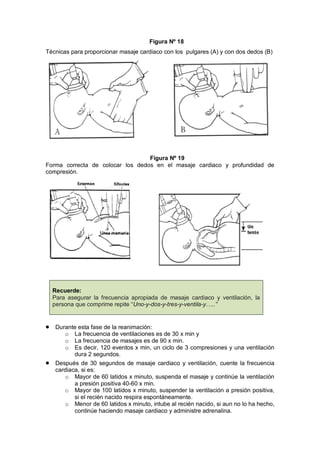 Figura Nº 18
Técnicas para proporcionar masaje cardiaco con los pulgares (A) y con dos dedos (B)
Figura Nº 19
Forma correcta de colocar los dedos en el masaje cardiaco y profundidad de
compresión.
Recuerde:
Para asegurar la frecuencia apropiada de masaje cardiaco y ventilación, la
persona que comprime repite “Uno-y-dos-y-tres-y-ventila-y…..”
• Durante esta fase de la reanimación:
o La frecuencia de ventilaciones es de 30 x min y
o La frecuencia de masajes es de 90 x min.
o Es decir, 120 eventos x min, un ciclo de 3 compresiones y una ventilación
dura 2 segundos.
• Después de 30 segundos de masaje cardiaco y ventilación, cuente la frecuencia
cardiaca, si es:
o Mayor de 60 latidos x minuto, suspenda el masaje y continúe la ventilación
a presión positiva 40-60 x min.
o Mayor de 100 latidos x minuto, suspender la ventilación a presión positiva,
si el recién nacido respira espontáneamente.
o Menor de 60 latidos x minuto, intube al recién nacido, si aun no lo ha hecho,
continúe haciendo masaje cardiaco y administre adrenalina.
 
