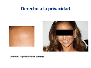 Derecho a la privacidad
Derecho a la privacidad del paciente.
 