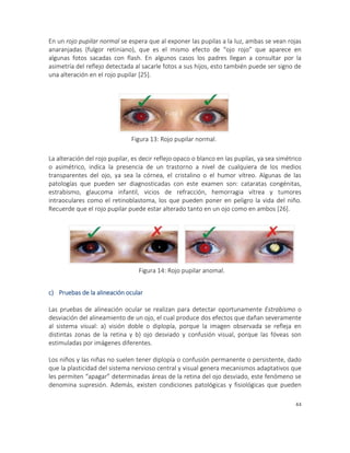 44
En un rojo pupilar normal se espera que al exponer las pupilas a la luz, ambas se vean rojas
anaranjadas (fulgor retiniano), que es el mismo efecto de “ojo rojo” que aparece en
algunas fotos sacadas con flash. En algunos casos los padres llegan a consultar por la
asimetría del reflejo detectada al sacarle fotos a sus hijos, esto también puede ser signo de
una alteración en el rojo pupilar [25].
La alteración del rojo pupilar, es decir reflejo opaco o blanco en las pupilas, ya sea simétrico
o asimétrico, indica la presencia de un trastorno a nivel de cualquiera de los medios
transparentes del ojo, ya sea la córnea, el cristalino o el humor vítreo. Algunas de las
patologías que pueden ser diagnosticadas con este examen son: cataratas congénitas,
estrabismo, glaucoma infantil, vicios de refracción, hemorragia vítrea y tumores
intraoculares como el retinoblastoma, los que pueden poner en peligro la vida del niño.
Recuerde que el rojo pupilar puede estar alterado tanto en un ojo como en ambos [26].
c) Pruebas de la alineación ocular
Las pruebas de alineación ocular se realizan para detectar oportunamente Estrabismo o
desviación del alineamiento de un ojo, el cual produce dos efectos que dañan severamente
al sistema visual: a) visión doble o diplopía, porque la imagen observada se refleja en
distintas zonas de la retina y b) ojo desviado y confusión visual, porque las fóveas son
estimuladas por imágenes diferentes.
Los niños y las niñas no suelen tener diplopía o confusión permanente o persistente, dado
que la plasticidad del sistema nervioso central y visual genera mecanismos adaptativos que
les permiten “apagar” determinadas áreas de la retina del ojo desviado, este fenómeno se
denomina supresión. Además, existen condiciones patológicas y fisiológicas que pueden
Foto 3
Figura 13: Rojo pupilar normal.
Figura 14: Rojo pupilar anomal.
 